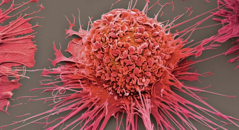 Cancer Cells Send MicroRNA In Exosomes to Macrophages, Rewiring Them for Tumorigenesis